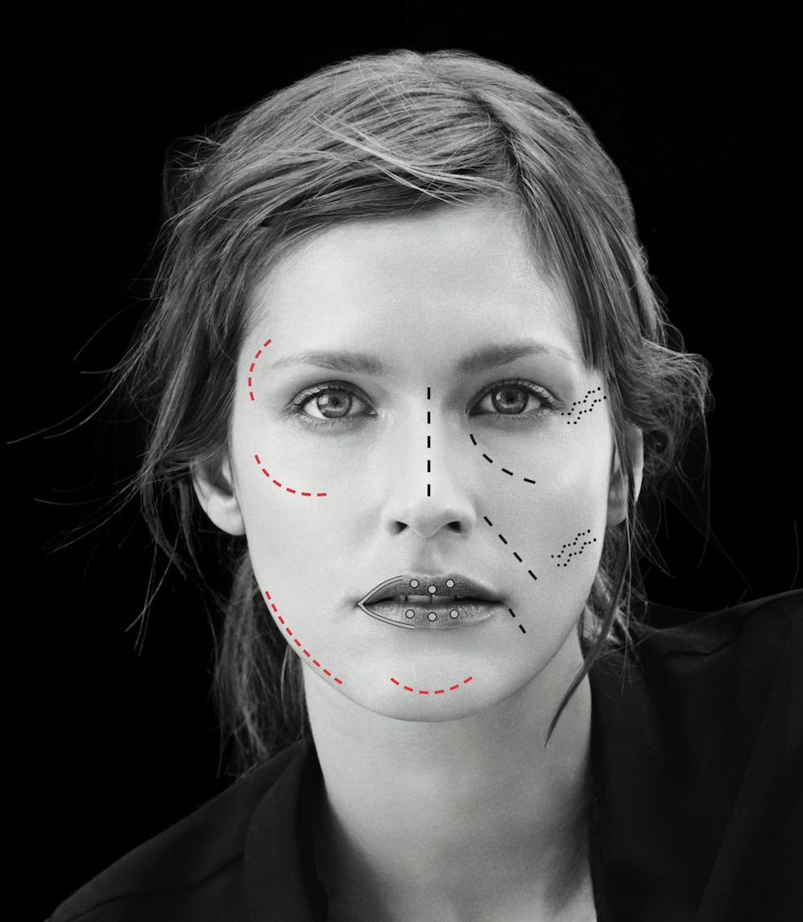 french touch medecine esthétique